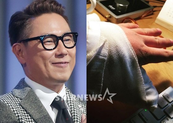 가수 윤종신과 부상 후 수술한 왼손 /사진=스타뉴스, 윤종신 SNS
