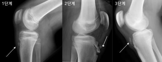 /사진제공=안산에이스병원