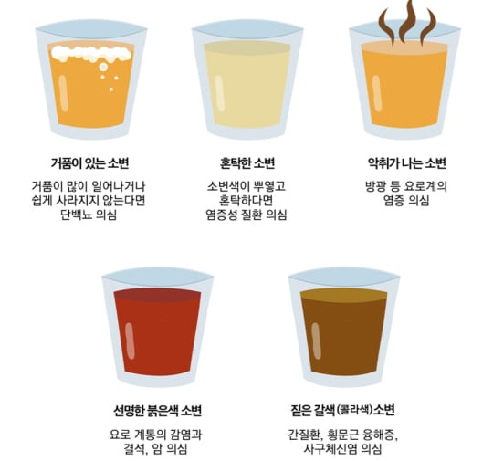 /사진제공=이대목동병원