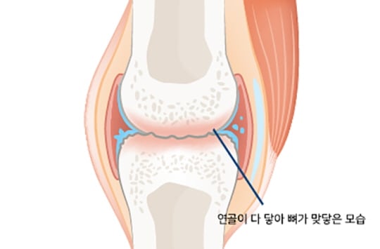 /사진제공=안산 에이스병원