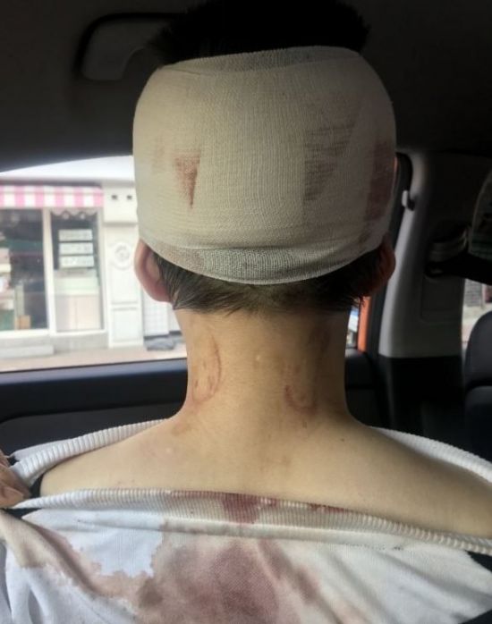 이수역 폭행 피해자의 모습 /사진=온라인 커뮤니티