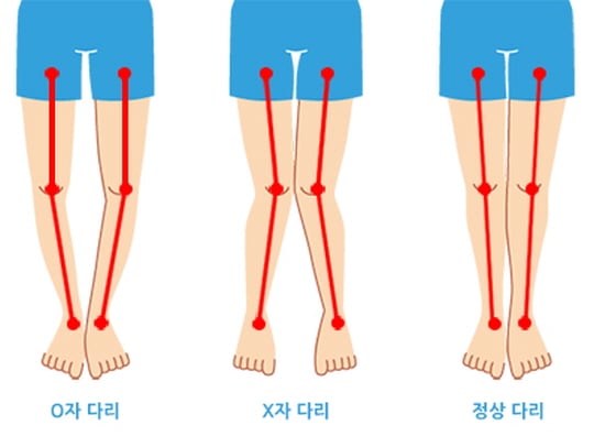 /사진제공=안산에이스병원