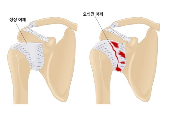 /사진제공=아산 에이스병원