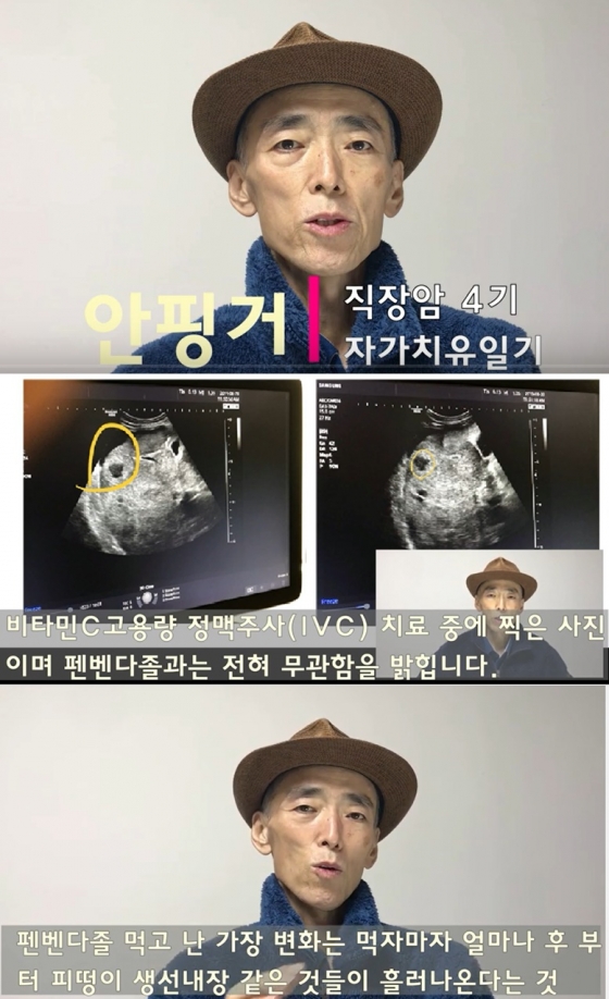/사진=안핑거 유튜브