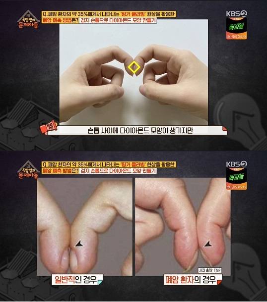 /사진=KBS 2TV '옥탑방의 문제아들' 캡처