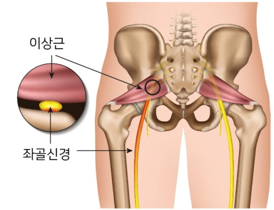 /사진제공=안산 에이스병원