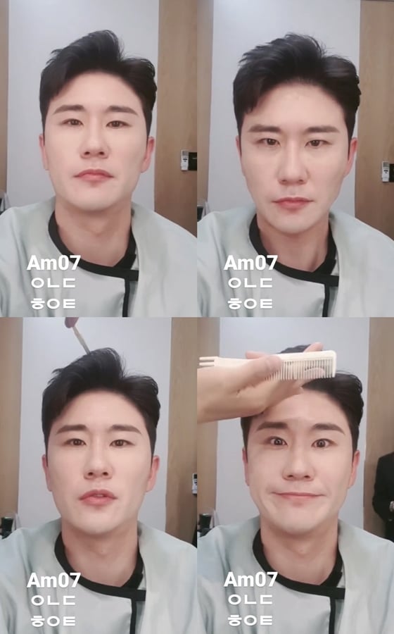 /사진=영탁 인스타그램 스토리