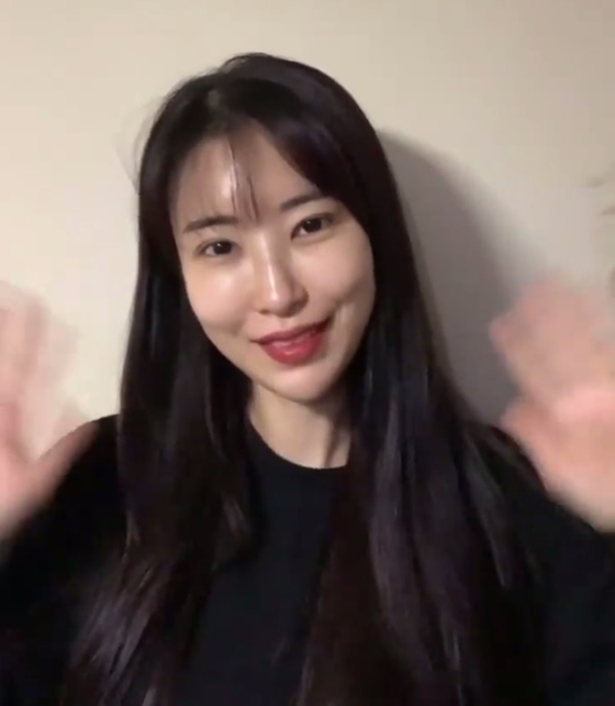 쌍꺼풀 수술 후 근황 이세영/사진=이세영 인스타그램