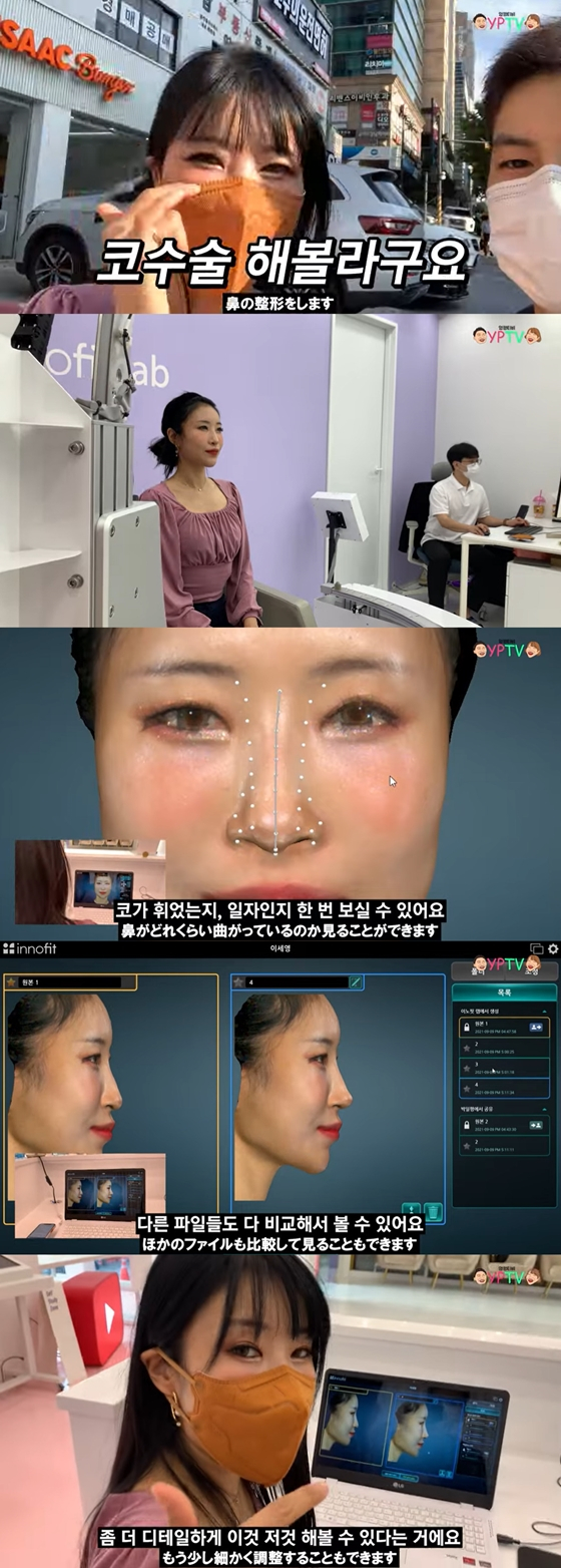 이세영이 유튜브 채널 '영평티비'에 남자친구와 코 성형 관련 콘텐츠를 게재했다./사진=유튜브 채널 '영평티비' 영상 캡처