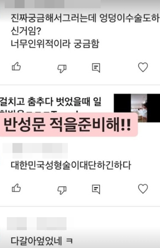 /사진=이세영 인스타그램 스토리 캡처