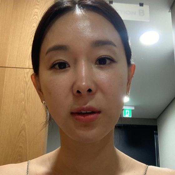 이지혜/사진=이지혜 인스타그램