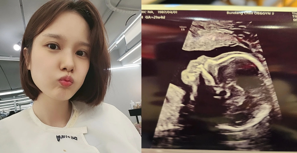 /사진=써니힐 빛나 개인 채널