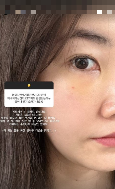/사진=9기 옥순 고초희