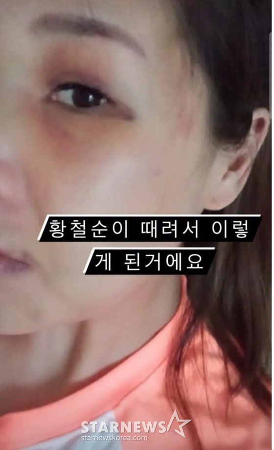 /사진=황철순 아내
