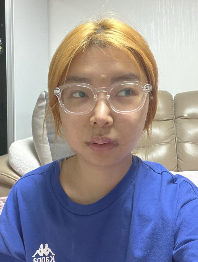 /사진=10기 영자 인스타그램