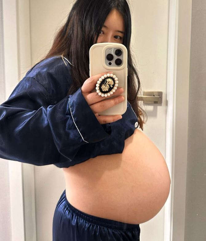 /사진=베니