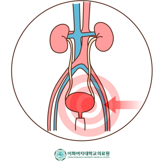 /사진제공=이화의료원