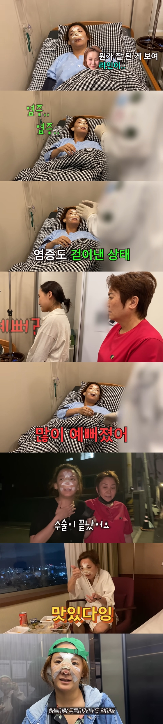 유튜브 채널 '방가네'에서 고은아의 코 재수술 후 모습이 공개됐다./사진=유튜브 채널 '방가네' 영상 캡처