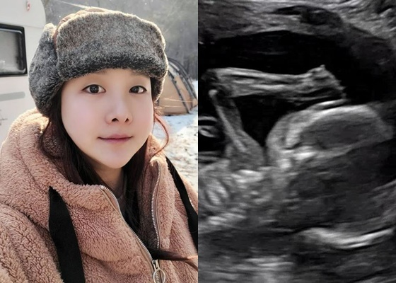 /사진=노희지 인스타그램