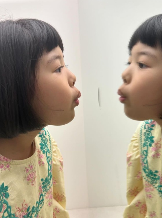 로아/사진=조윤희