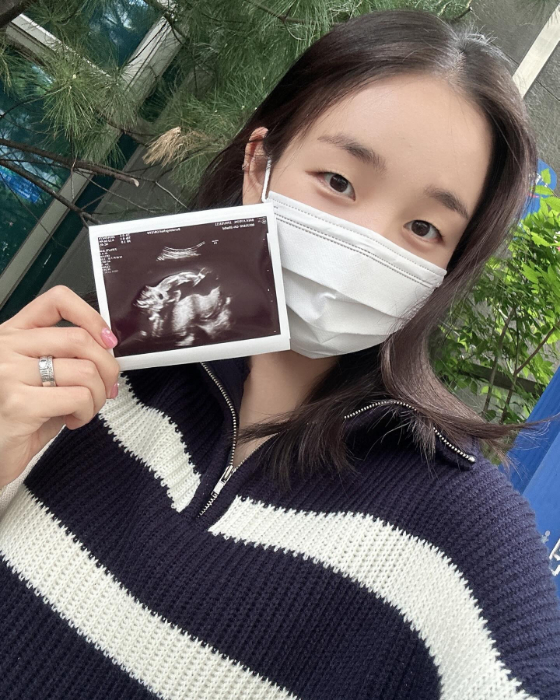 가수 백아연./사진=백아연 인스타그램
