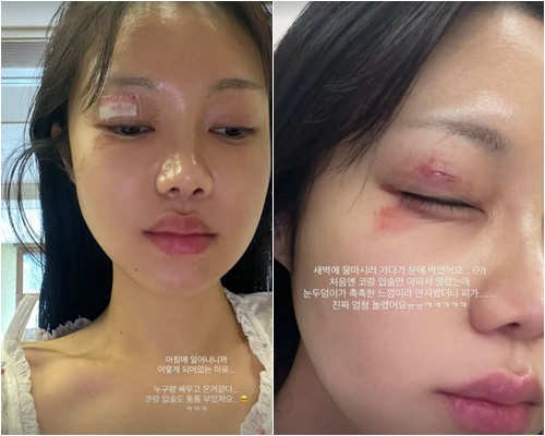 /사진=김연지 개인계정
