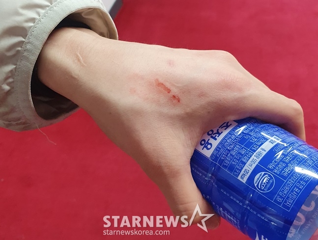 삼성생명 배혜윤이 14일 BNK전 종료 후 손에 난 상처를 보여주고 있다. /사진=양정웅 기자
