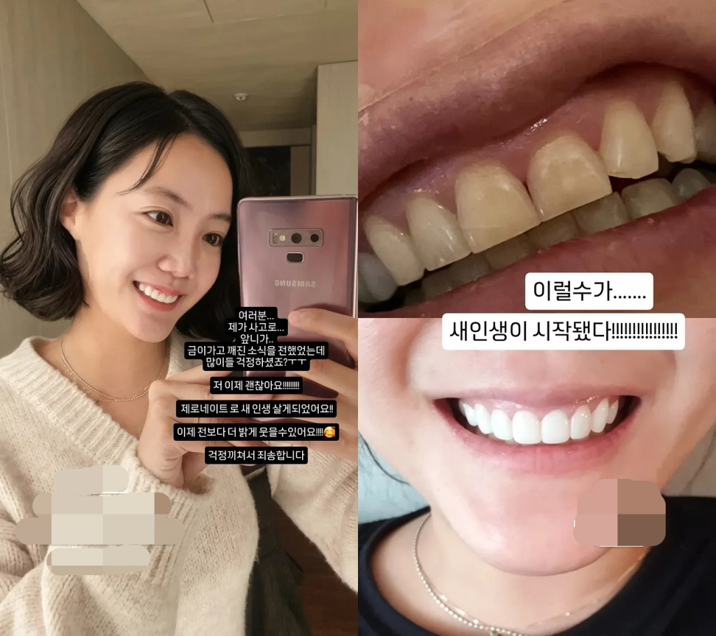 사진=고은아 인스타그램