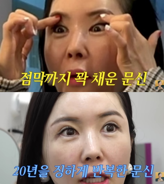 장영란/사진=유튜브 A급 장영란