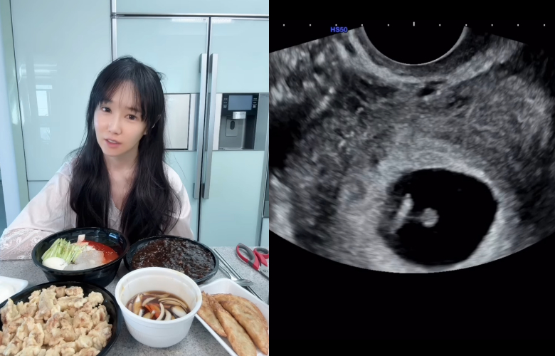 /사진=16기 옥순 SNS