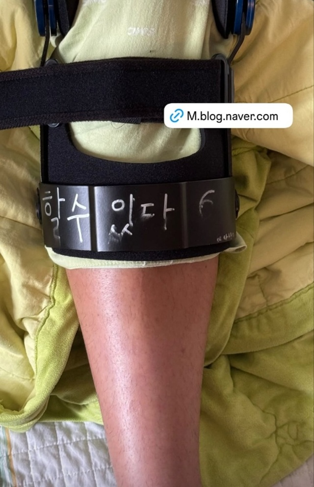 문지환의 깁스에 적힌 메시지 '할 수 있다.' /사진=문지환 SNS
