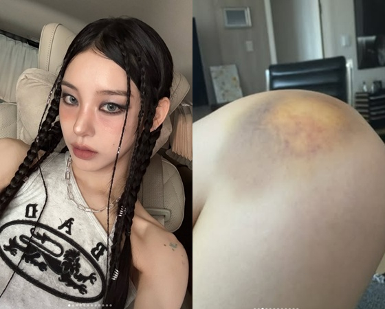 /사진=노제 SNS