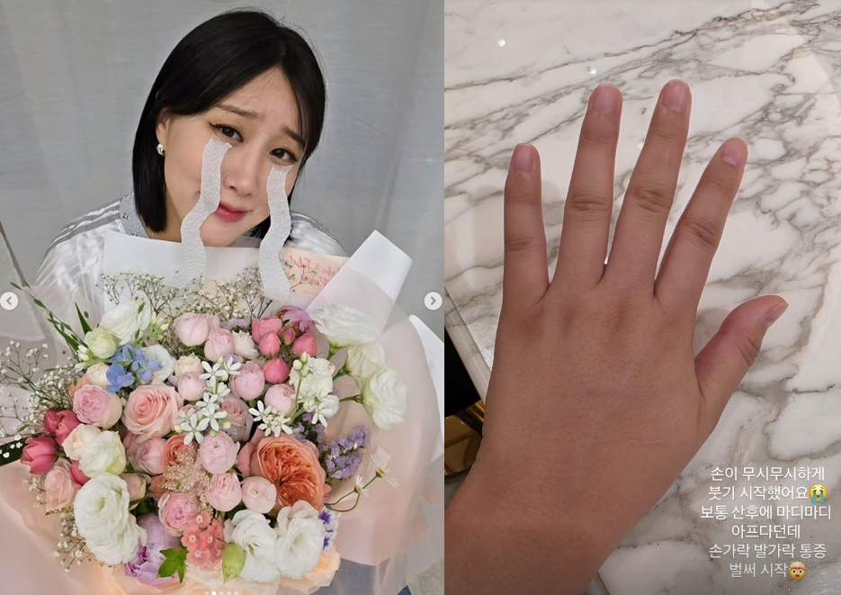 /사진=임라라 SNS