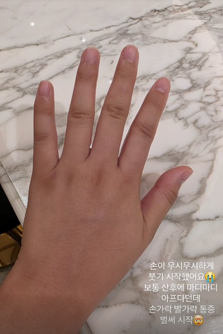 /사진=임라라 SNS