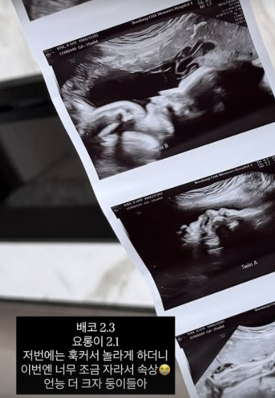 /사진=김지혜 SNS