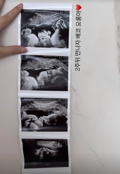 /사진=김지혜 SNS